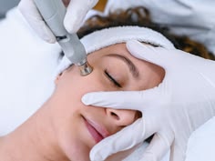Laser face Skin Resurfacing